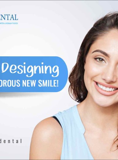 Smile designing treatment India
